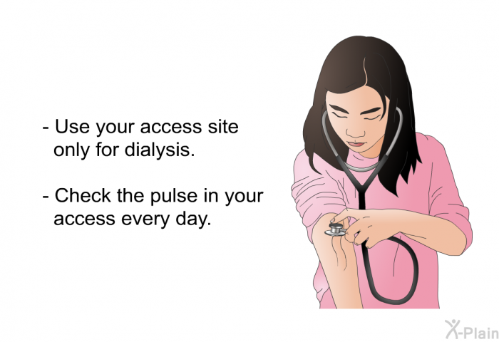 Use your access site only for dialysis. Check the pulse in your access every day.