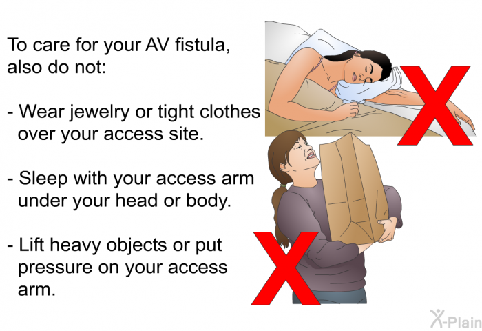 To care for your AV fistula, also do not:  Wear jewelry or tight clothes over your access site. Sleep with your access arm under your head or body. Lift heavy objects or put pressure on your access arm.