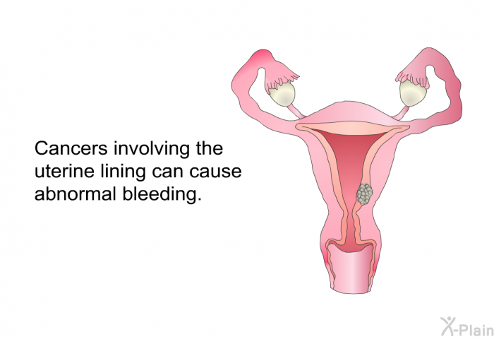 Cancers involving the uterine lining can cause abnormal bleeding.