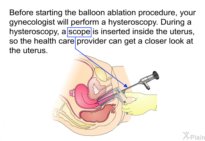 Before starting the balloon ablation procedure, your gynecologist will perform a hysteroscopy. During a hysteroscopy, a scope is inserted inside the uterus, so the health care provider can get a closer look at the uterus.
