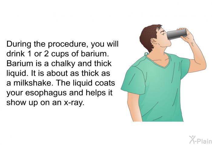 During the procedure, you will drink 1 or 2 cups of barium. Barium is a chalky and thick liquid. It is about as thick as a milkshake. The liquid coats your esophagus and helps it show up on an x-ray.