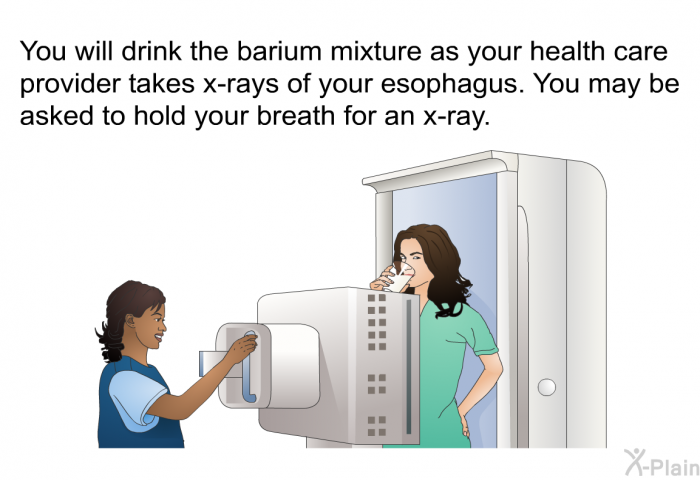 You will drink the barium mixture as your health care provider takes x-rays of your esophagus. You may be asked to hold your breath for an x-ray.