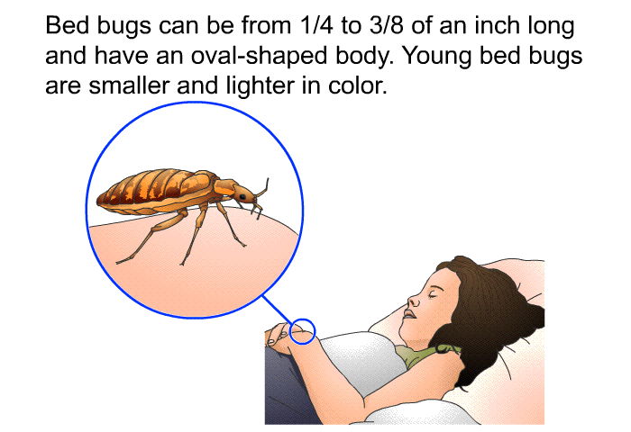 Bed bugs can be from 1/4 to 3/8 of an inch long and have an oval-shaped body. Young bed bugs are smaller and lighter in color.