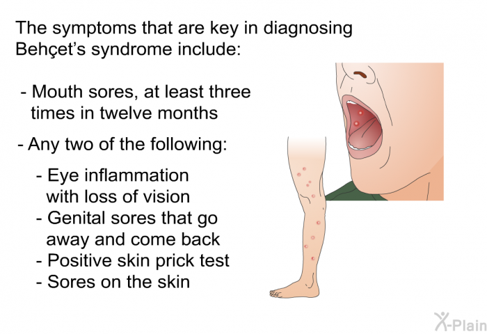 The symptoms that are key in diagnosing Behçet's syndrome include:  Mouth sores, at least three times in twelve months Any two of the following:    Eye inflammation with loss of vision Genital sores that go away and come back Positive skin prick test Sores on the skin
