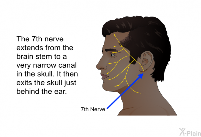 The 7<SUP>th</SUP> nerve extends from the brain stem to a very narrow canal in the skull. It then exits the skull just behind the ear.