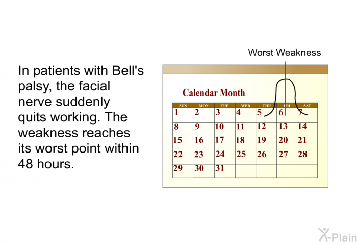 In patients with Bell's palsy, the facial nerve suddenly quits working. The weakness reaches its worst point within 48 hours.