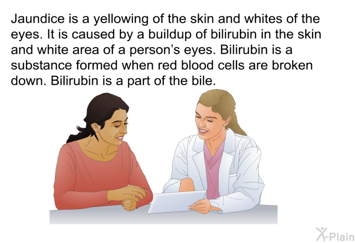 Jaundice is a yellowing of the skin and whites of the eyes. It is caused by a buildup of bilirubin in the skin and white area of a person's eyes. Bilirubin is a substance formed when red blood cells are broken down. Bilirubin is a part of the bile.