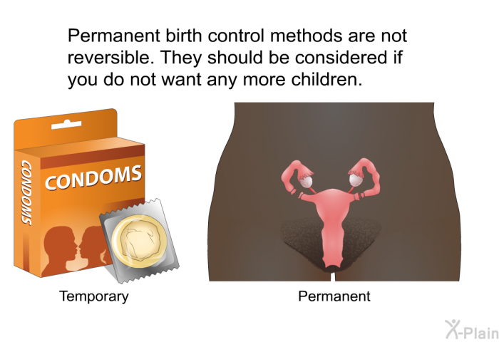 Permanent birth control methods are not reversible. They should be considered if you do not want any more children.