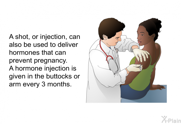 A shot, or injection, can also be used to deliver hormones that can prevent pregnancy. A hormone injection is given in the buttocks or arm every 3 months.