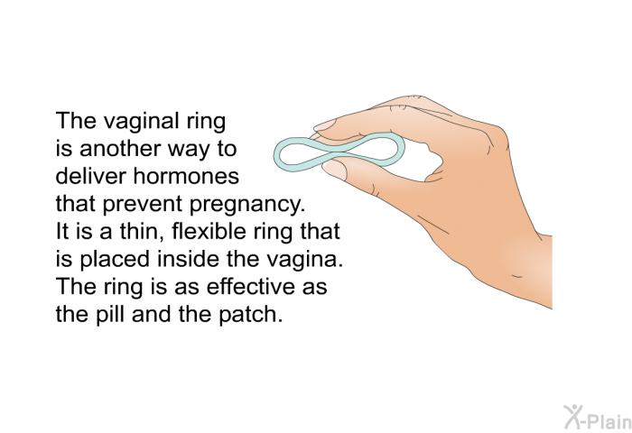 The vaginal ring is another way to deliver hormones that prevent pregnancy. It is a thin, flexible ring that is placed inside the vagina. The ring is as effective as the pill and the patch.