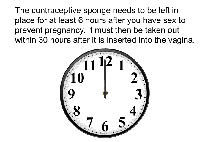 The contraceptive sponge needs to be left in place for at least 6 hours after you have sex to prevent pregnancy. It must then be taken out within 30 hours after it is inserted into the vagina.