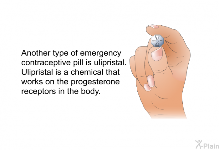 Another type of emergency contraceptive pill is ulipristal. Ulipristal is a chemical that works on the progesterone receptors in the body.