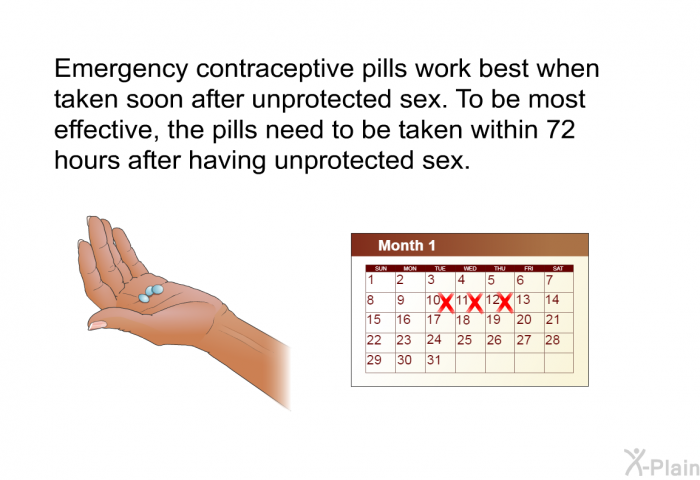 Emergency contraceptive pills work best when taken soon after unprotected sex. To be most effective, the pills need to be taken within 72 hours after having unprotected sex.