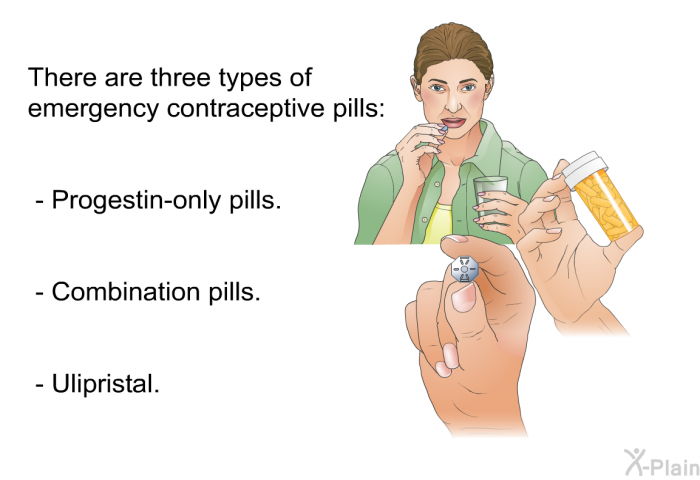 There are three types of emergency contraceptive pills:  Progestin-only pills. Combination pills. Ulipristal.