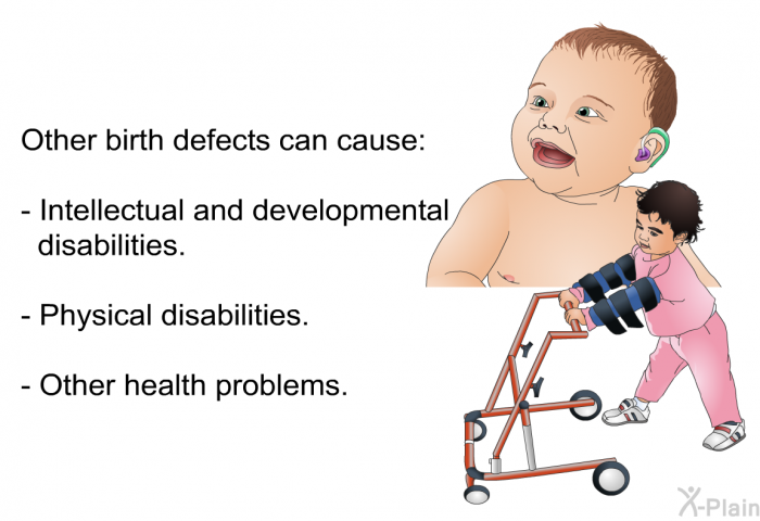 Other birth defects can cause:  Intellectual and developmental disabilities. Physical disabilities. Other health problems.