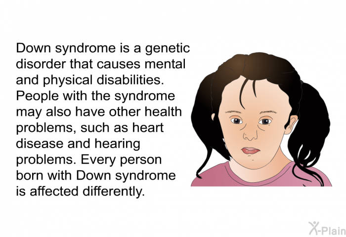 Down syndrome is a genetic disorder that causes mental and physical disabilities. People with the syndrome may also have other health problems, such as heart disease and hearing problems. Every person born with Down syndrome is affected differently.