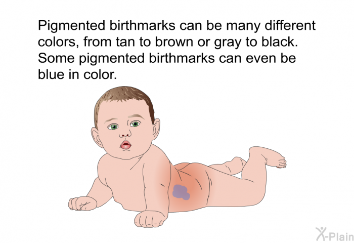 Pigmented birthmarks can be many different colors, from tan to brown or gray to black. Some pigmented birthmarks can even be blue in color.