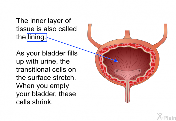 The inner layer of tissue is also called the lining. As your bladder fills up with urine, the transitional cells on the surface stretch. When you empty your bladder, these cells shrink.