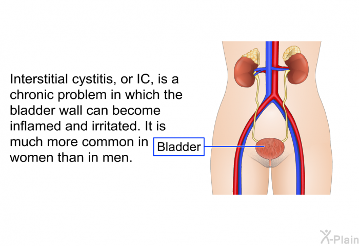 Interstitial cystitis, or IC, is a chronic problem in which the bladder wall can become inflamed and irritated. It is much more common in women than in men.