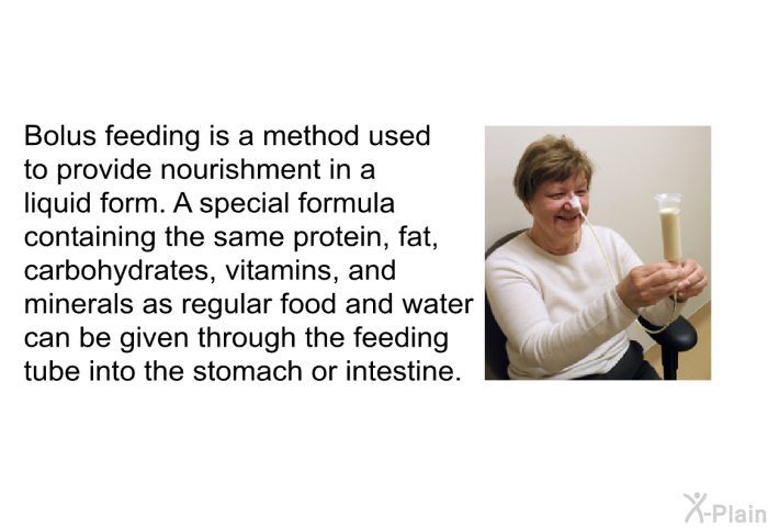 Bolus feeding is a method used to provide nourishment in a liquid form. A special formula containing the same protein, fat, carbohydrates, vitamins, and minerals as regular food and water can be given through the feeding tube into the stomach or intestine.