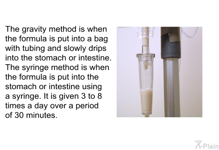 The gravity method is when the formula is put into a bag with tubing and slowly drips into the stomach or intestine. The syringe method is when the formula is put into the stomach or intestine using a syringe. It is given 3 to 8 times a day over a period of 30 minutes.
