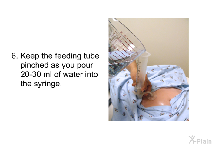 Keep the feeding tube pinched as you pour 20-30 ml of water into the syringe.