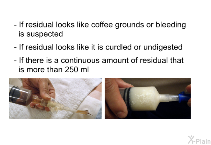 If residual looks like coffee grounds or bleeding is suspected If residual looks like it is curdled or undigested If there is a continuous amount of residual that is more than 250 ml