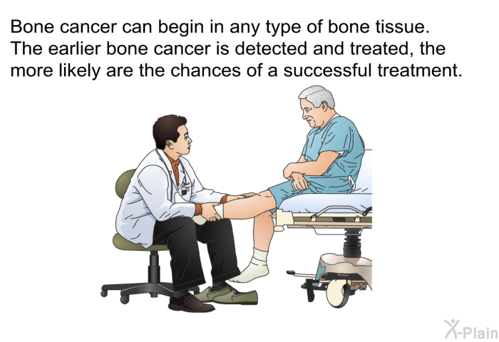 Bone cancer can begin in any type of bone tissue. The earlier bone cancer is detected and treated, the more likely are the chances of a successful treatment.