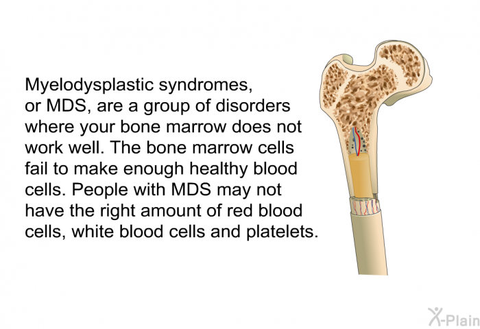 Myelodysplastic syndromes, or MDS, are a group of disorders where your bone marrow does not work well. The bone marrow cells fail to make enough healthy blood cells. People with MDS may not have the right amount of red blood cells, white blood cells and platelets.