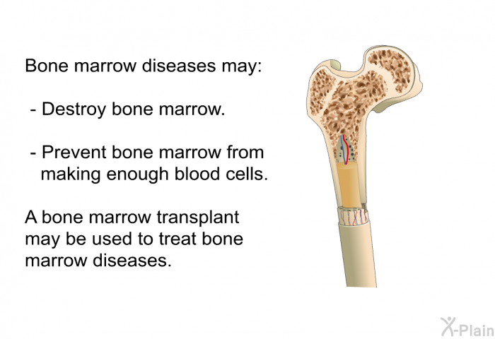 Bone marrow diseases may:  Destroy bone marrow. Prevent bone marrow from making enough blood cells.  
 A bone marrow transplant may be used to treat bone marrow diseases.