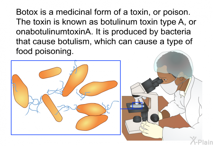 Botox is a medicinal form of a toxin, or poison. The toxin is known as botulinum toxin type A, or onabotulinumtoxinA. It is produced by bacteria that cause botulism, which can cause a type of food poisoning.