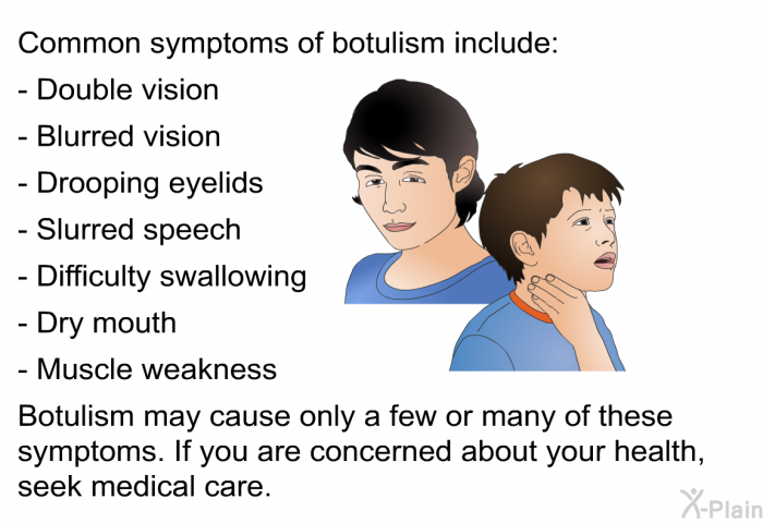 Common symptoms of botulism include:  Double vision Blurred vision Drooping eyelids Slurred speech Difficulty swallowing Dry mouth Muscle weakness  
Botulism may cause only a few or many of these symptoms. If you are concerned about your health, seek medical care.