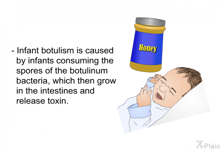 Infant botulism is caused by infants consuming the spores of the botulinum bacteria, which then grow in the intestines and release toxin.