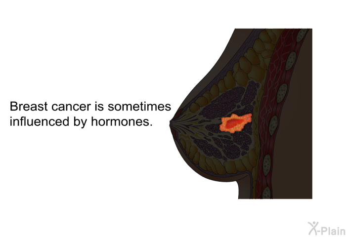 Breast cancer is sometimes influenced by hormones.