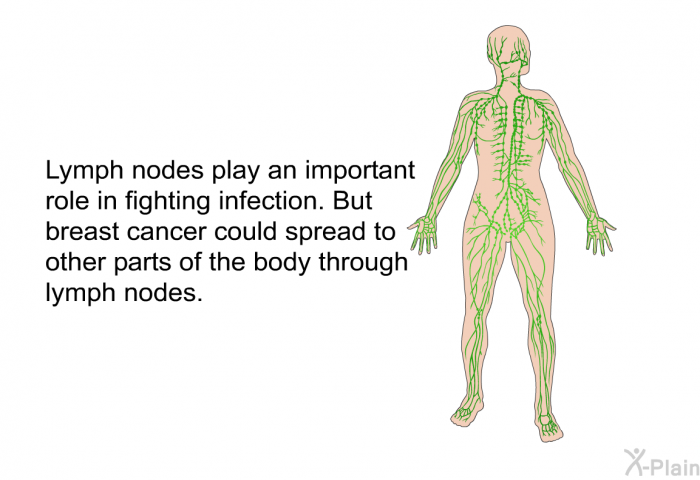 Lymph nodes play an important role in fighting infection. But breast cancer could spread to other parts of the body through lymph nodes.