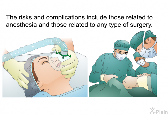 The risks and complications include those related to anesthesia and those related to any type of surgery.