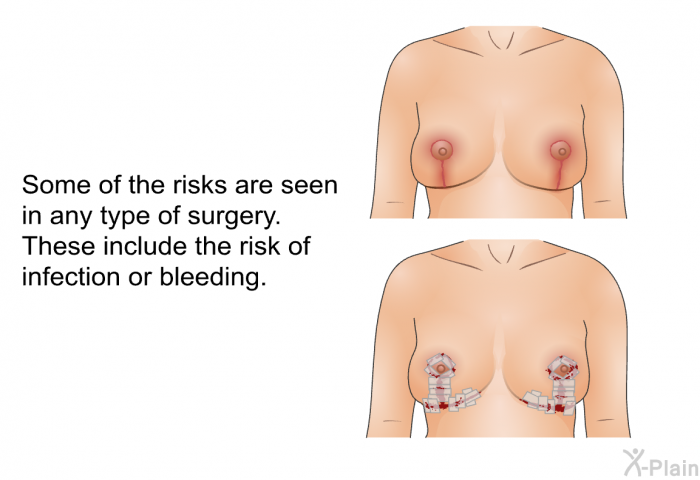 Some of the risks are seen in any type of surgery. These include the risk of infection or bleeding.