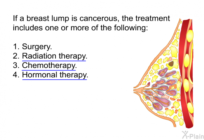 If a breast lump is cancerous, the treatment includes one or more of the following:  Surgery. Radiation therapy. Chemotherapy. Hormonal therapy.