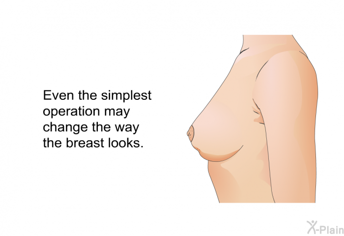 Even the simplest operation may change the way the breast looks.