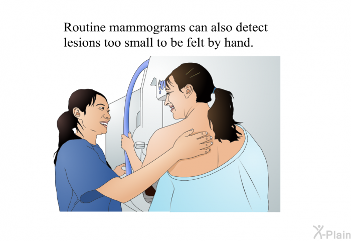 Routine mammograms can also detect lesions too small to be felt by hand.