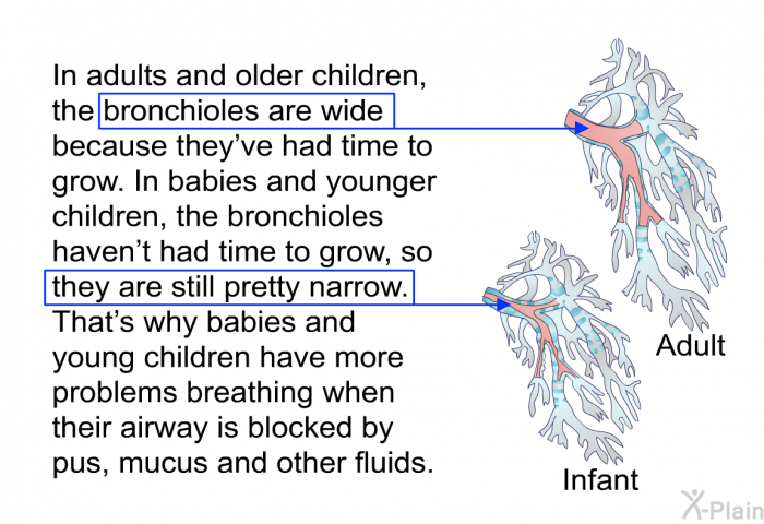 In adults and older children, the bronchioles are wide because they've had time to grow. In babies and younger children, the bronchioles haven't had time to grow, so they are still pretty narrow. That's why babies and young children have more problems breathing when their airway is blocked by pus, mucus and other fluids.