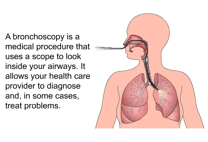 A bronchoscopy is a medical procedure that uses a scope to look inside your airways. It allows your health care provider to diagnose and, in some cases, treat problems.