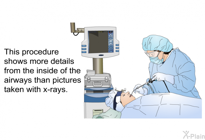 This procedure shows more details from the inside of the airways than pictures taken with x-rays.