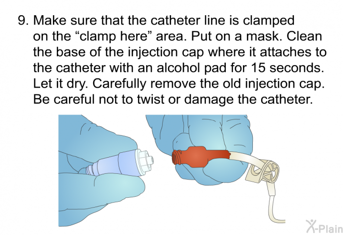Make sure that the catheter line is clamped on the &ldquo;clamp here&rdquo; area. Put on a mask. Clean the base of the injection cap where it attaches to the catheter with an alcohol pad for 15 seconds. Let it dry. Carefully remove the old injection cap. Be careful not to twist or damage the catheter.