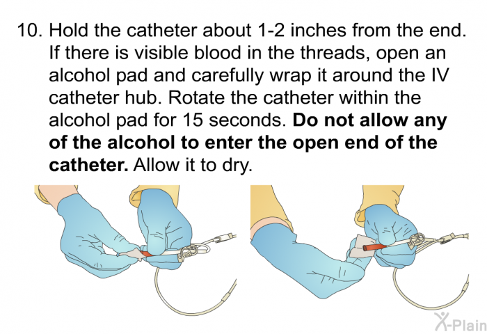 Hold the catheter about 1-2 inches from the end. If there is visible blood in the threads, open an alcohol pad and carefully wrap it around the IV catheter hub. Rotate the catheter within the alcohol pad for 15 seconds. Do not allow any of the alcohol to enter the open end of the catheter. Allow it to dry.