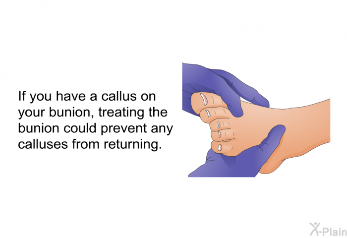 If you have a callus on your bunion, treating the bunion could prevent any calluses from returning.