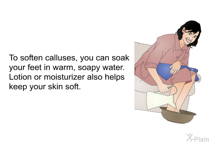 To soften calluses, you can soak your feet in warm, soapy water. Lotion or moisturizer also helps keep your skin soft.