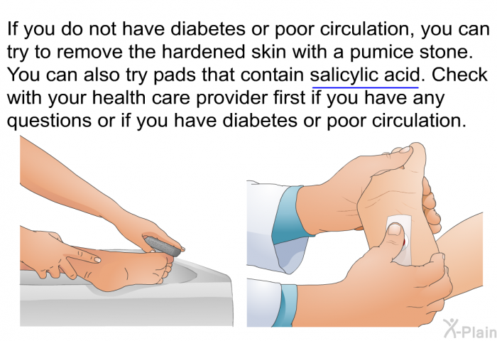 If you do not have diabetes or poor circulation, you can try to remove the hardened skin with a pumice stone. You can also try pads that contain salicylic acid. Check with your health care provider first if you have any questions or if you have diabetes or poor circulation.
