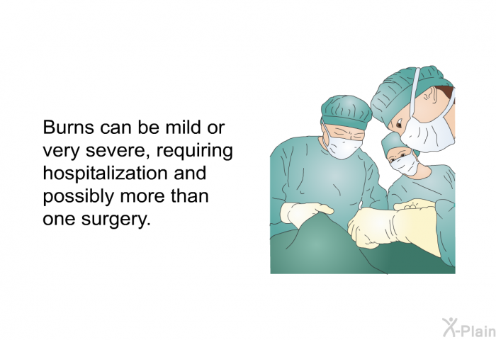 Burns can be mild or very severe, requiring hospitalization and possibly more than one surgery.