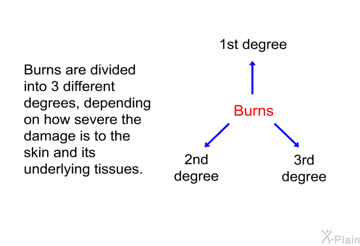 Burns are divided into 3 different degrees, depending on how severe the damage is to the skin and its underlying tissues.